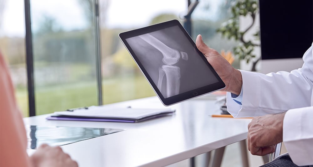 Quais são os tipos de RX Digital que existem?