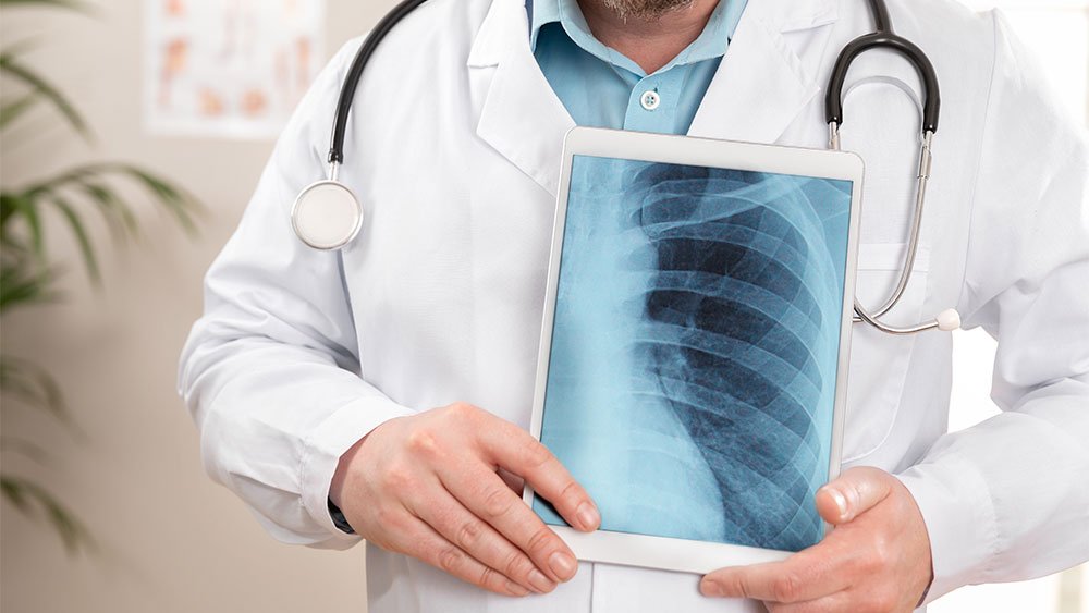 Raio X Digital: Conheça suas vantagens